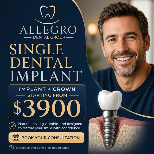 Allegro Dental · השתלת שן · מודעת קמפיין